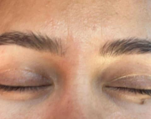 Eyebrow treatment